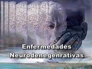 Enfermedades neurodegenerativas Párkinson y alhzéimer