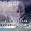 Enfermedades neurodegenerativas Párkinson y alhzéimer